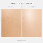 Macchie e uniformità prima e dopo - immagine illustrativa