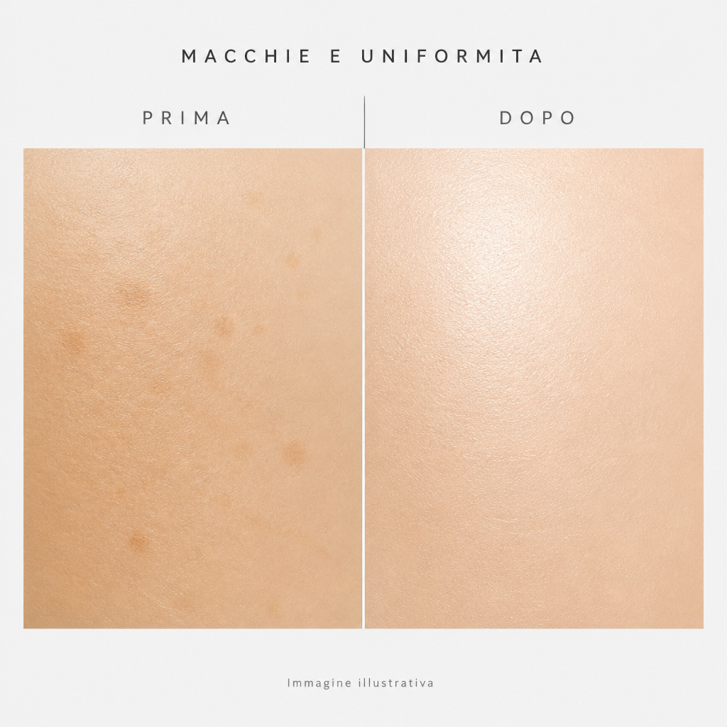 Macchie e uniformità prima e dopo - immagine illustrativa