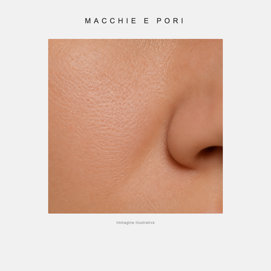 Macchie e pori - immagine illustrativa