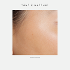 Tono e macchie - immagine illustrativa