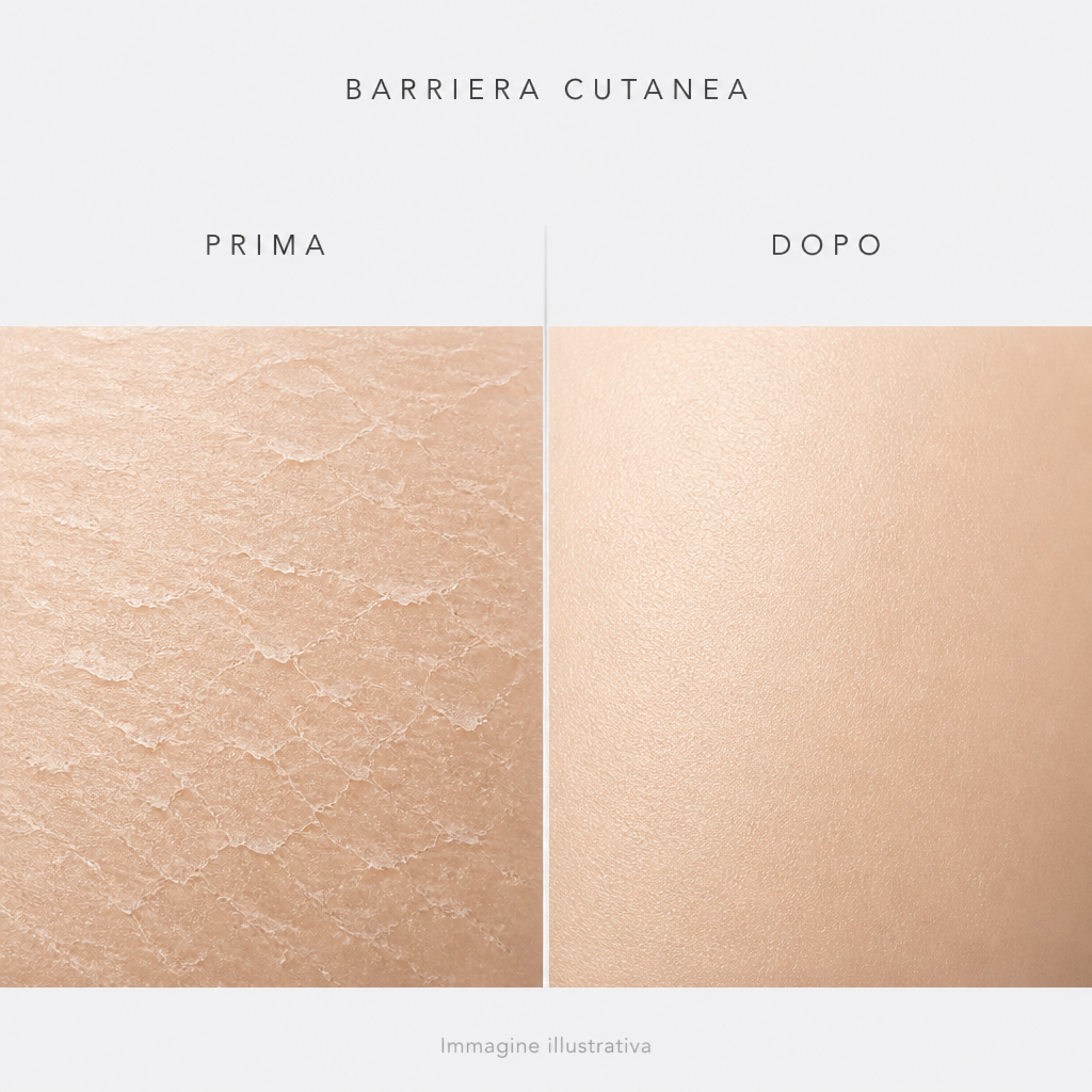 Barriera cutanea prima e dopo - immagine illustrativa