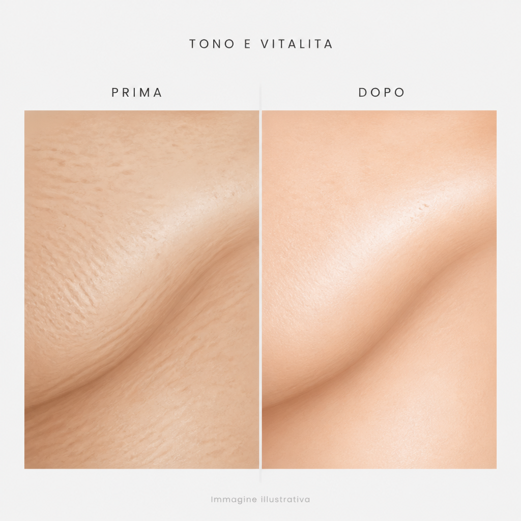 Tono e vitalità prima e dopo - immagine illustrativa
