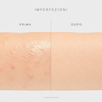 Imperfezioni prima e dopo - immagine illustrativa