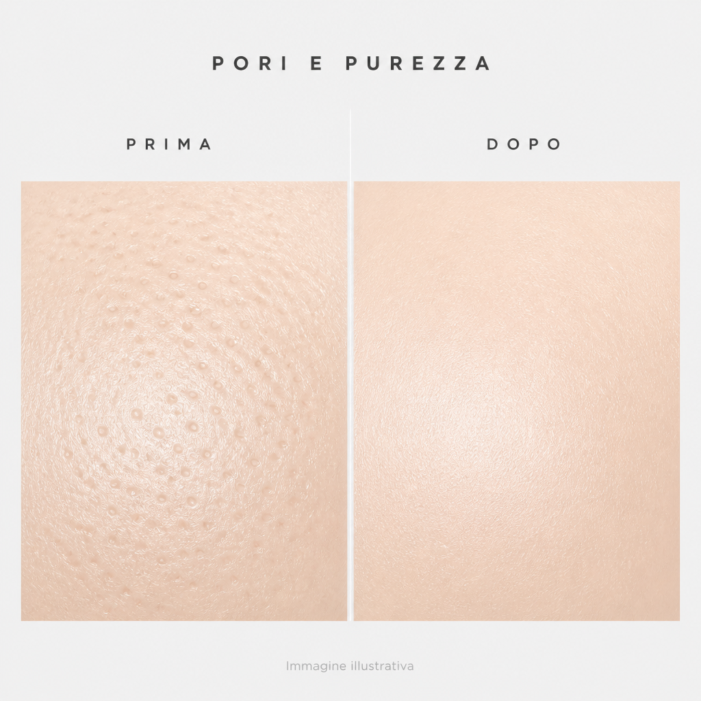 Pori e purezza prima e dopo - immagine illustrativa